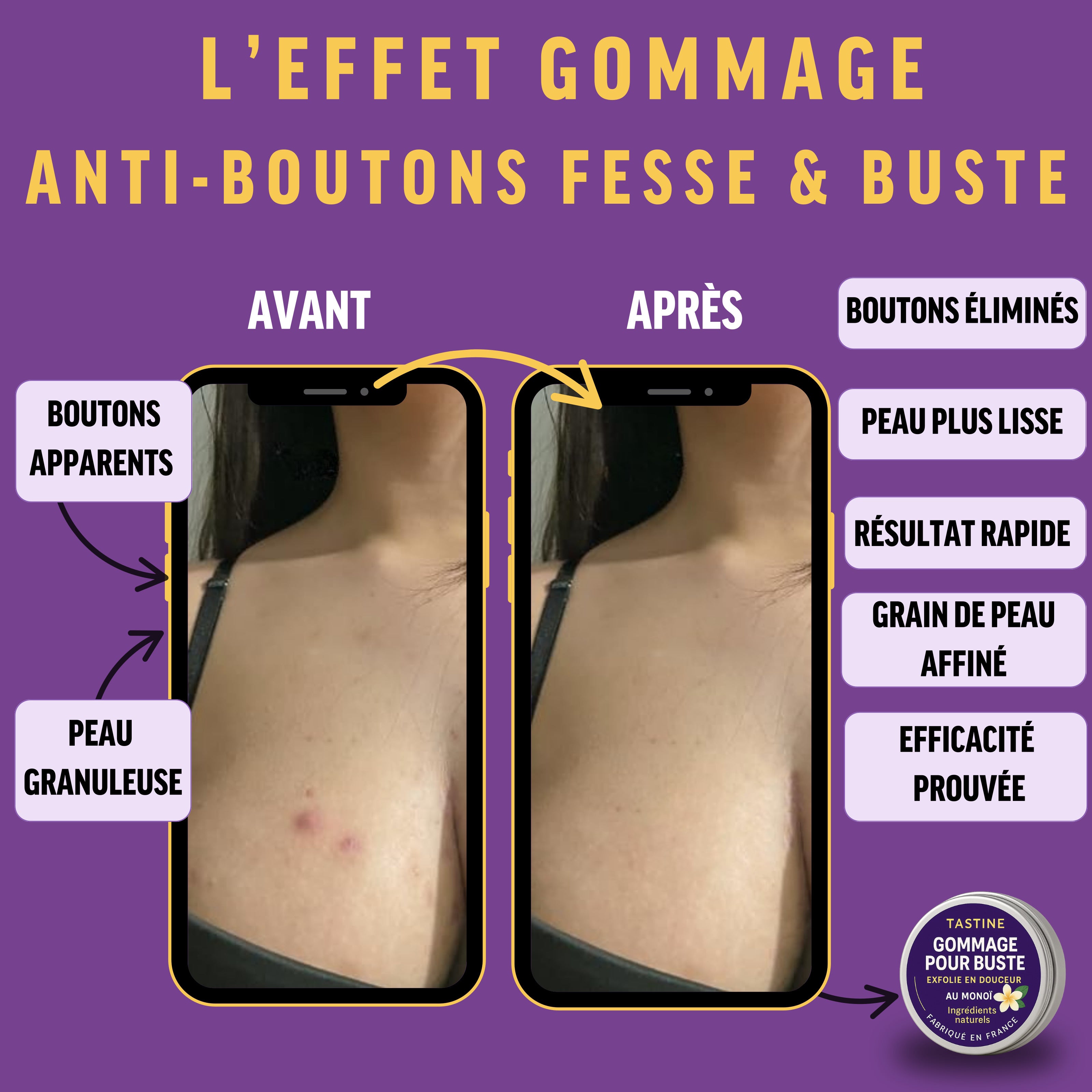 Avant et après l'utilisation du gommage pour buste, montrant une peau plus lisse et sans boutons.