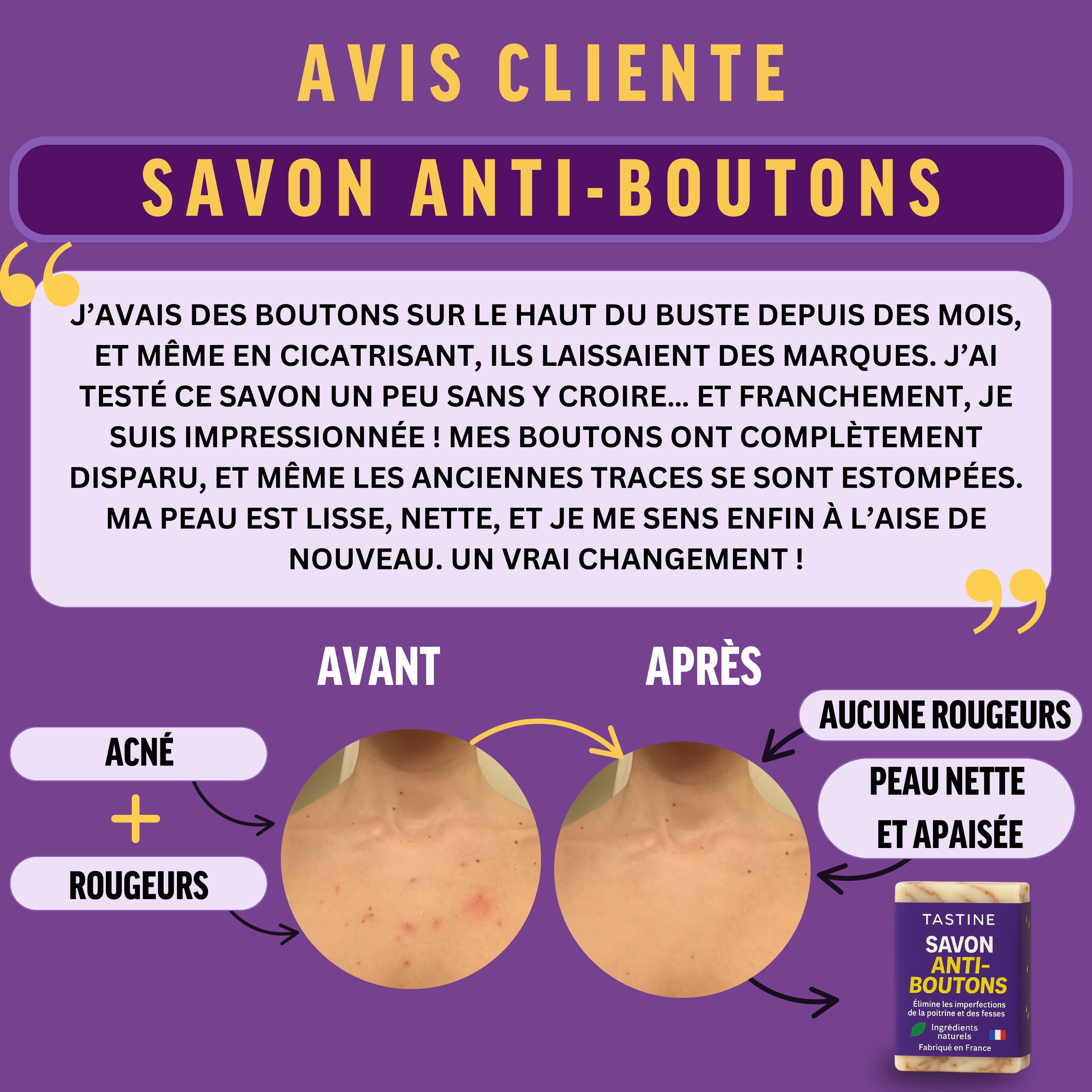 Client testimonial for anti-bump soap showing before and after results on bust area with smooth skin and no redness.